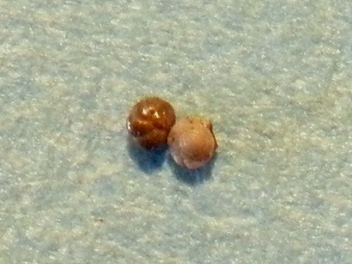 Foraminifera